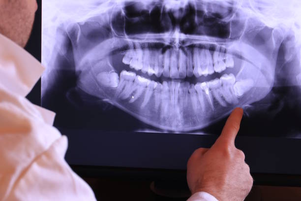 Best Emergency Treatment for Dental Infections or Abscesses in Horseshoe Bay, TX